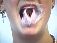 gum